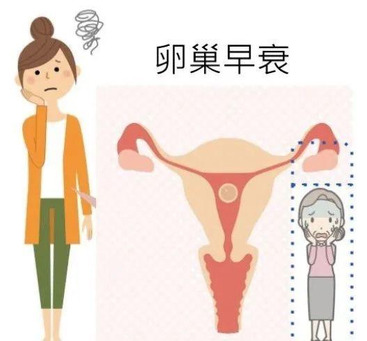 卵巢早衰的表现 苏州市孔仪瑞：关于卵巢的科普文章
