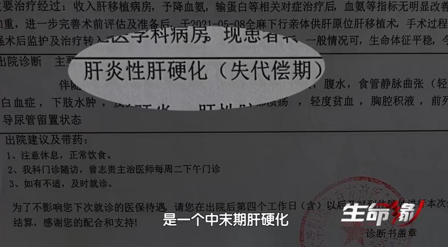可以确诊肝硬化的辅助检查方法是什么 合川市冉爱琰：关于肝硬化的科普文章