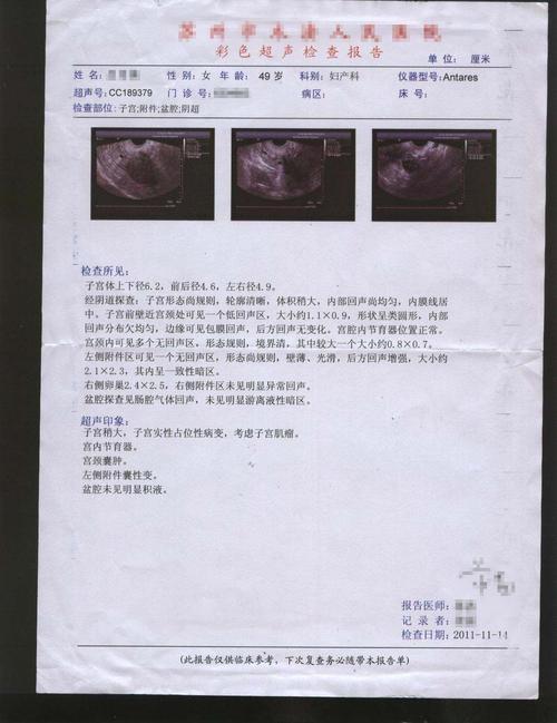 子宫肌瘤检查什么项目 白山市席莺霭：关于子宫肌瘤的优选文章