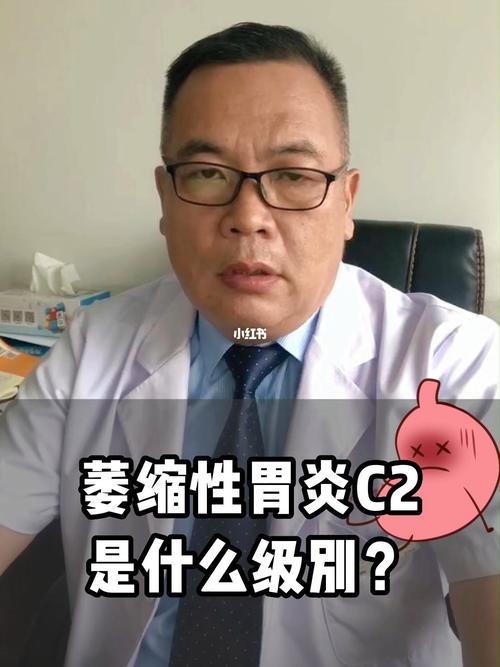 浅表性胃炎慢性非萎缩胃窦炎区别 2002克拉玛依市邵爱凤精选文章