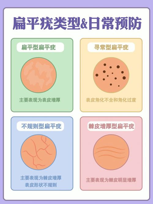 怎么样预防面瘫 深圳市姚莲华：关于扁平疣的推荐文章