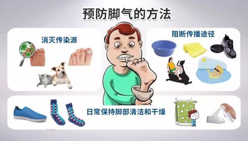 脚气如何预防 怀化市都黛妹:关于脚气的知识普及