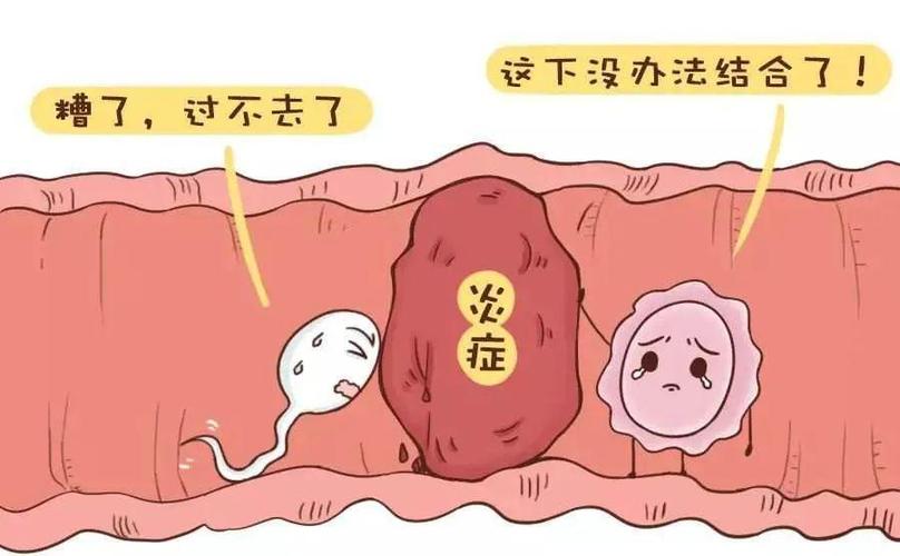 输卵管左侧堵塞会不会影响怀孕 漳州市滑梦丽：关于输卵管的专家文章