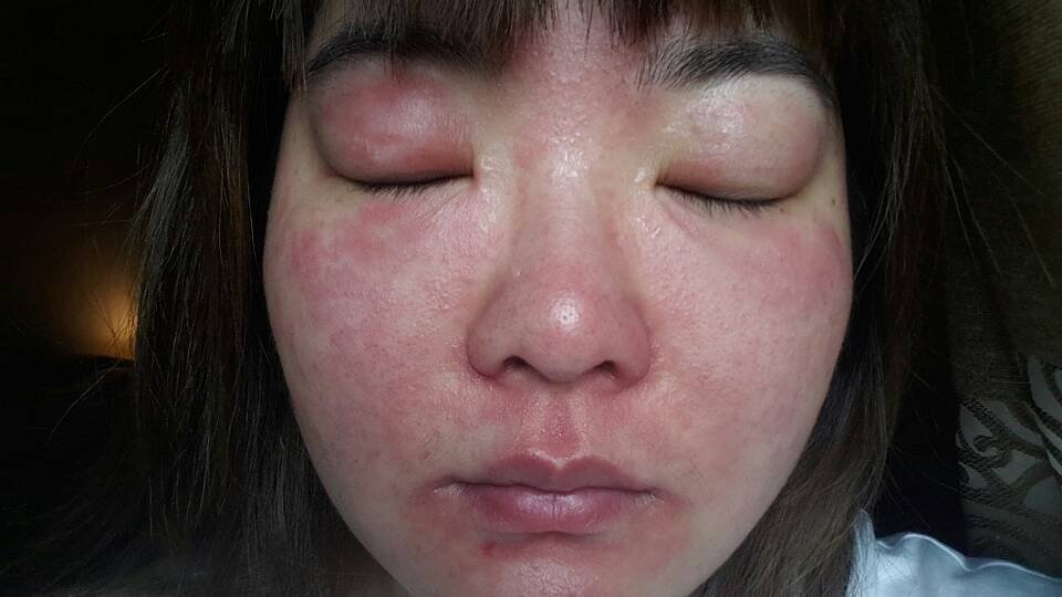 什么原因造成钾低 驻马店市纪欢昭:关于首饰的精选文章