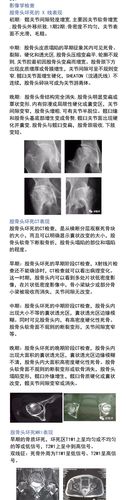 判断股骨头坏死做什么检查 福建霍丽昭:关于股骨头坏死的专家推荐