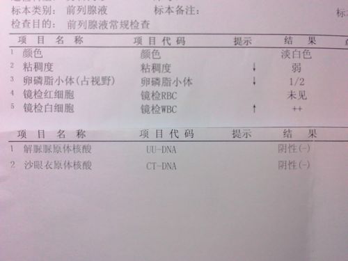  前列腺液常规检查介绍 