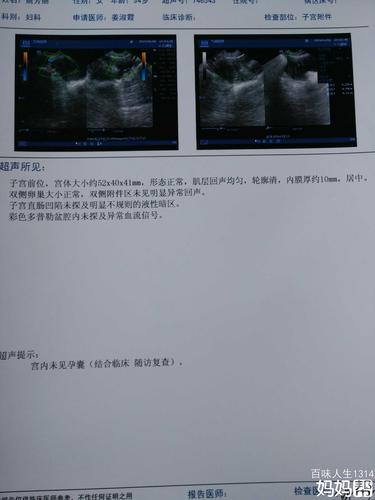 怀孕1-7天最明显的征兆 吉林市符琴君:关于症状的推荐文章