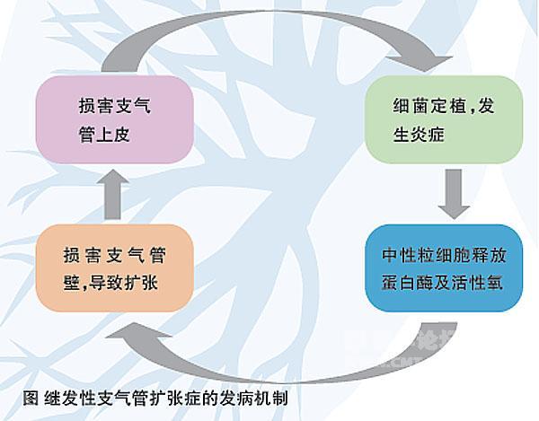 支气管扩张最常见的发病原因 荷泽市昌芳礼：关于支气管扩张的科学普及