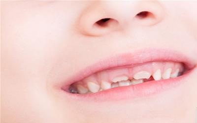 牙龈肿痛流脓是什么原因？ 