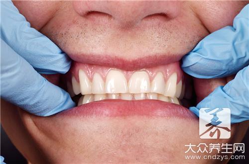 牙龈出血是什么原因造成的？止血的5个秘诀