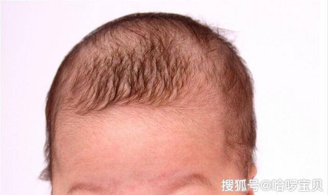 九个月的宝宝头发竖着长 2010荆门市邓君瑾精选文章
