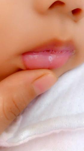 一个月大的宝宝嘴里有白毛是什么原因？ 