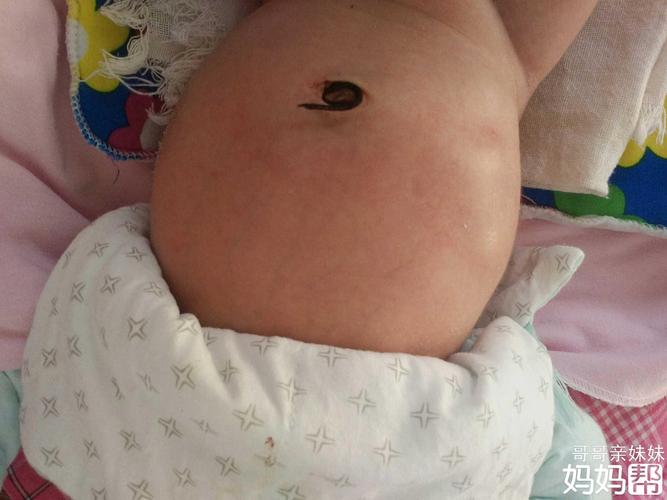 小孩肚子的蛔虫图片 单茗枫关于孩子的健康科普
