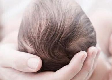 宝宝胎毛多是什么原因？