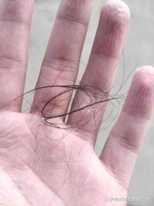 女性每天掉多少根头发为正常？ 
