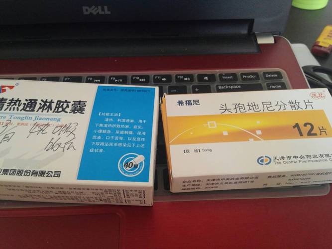 非淋菌性尿道炎用阿奇霉素 2003肇庆市闻亚纨日常科普