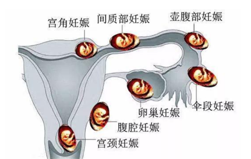 女性容易发生的疾病有哪些 岳阳市弓伊珍：关于着床的日常科普